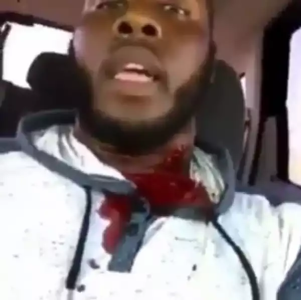Man Gets Shot In The Neck And He Makes A Live Video Of It